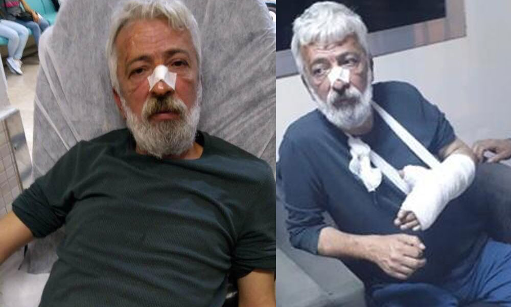 Gazeteci Özyol’a saldıran, MHP’li başkanın şoförü çıktı!